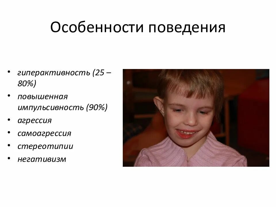 Стереотипия у детей что это такое. Стереотипия у детей что это. поведенческие стереотипии у детей это. двигательные стереотипии. двигательные стереотипии при аутизме.