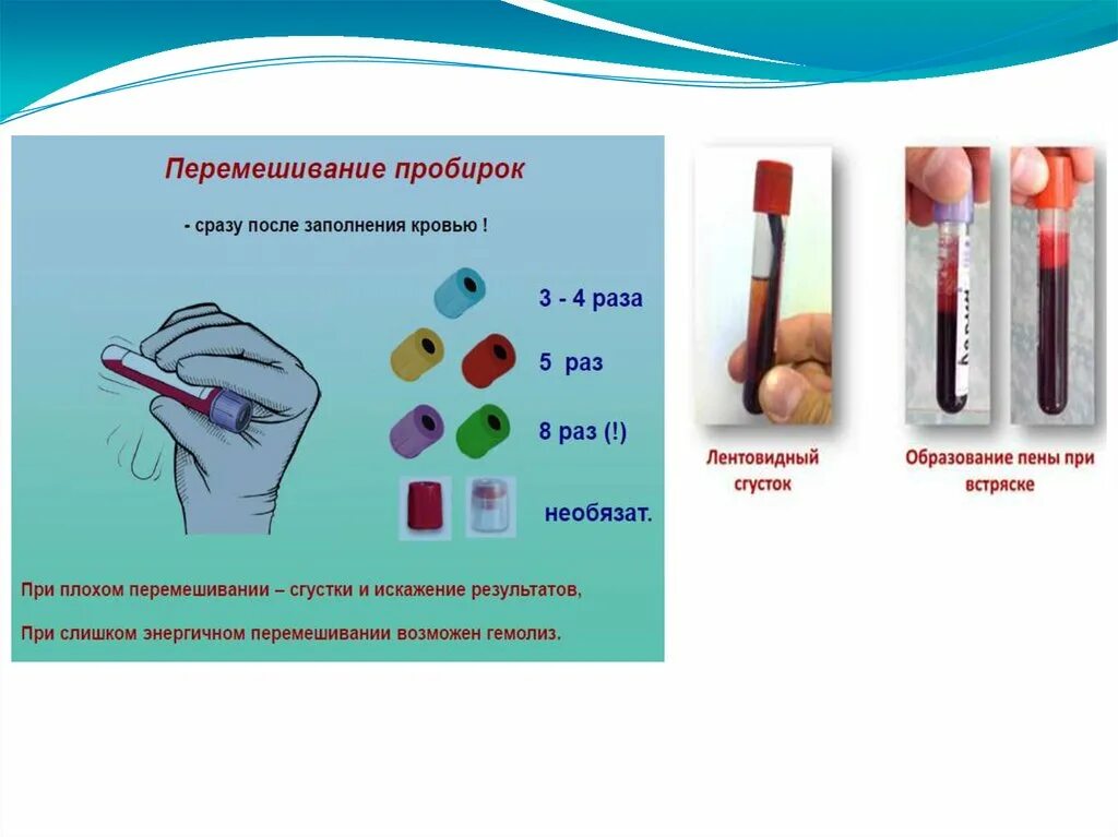 Забор крови какие пробирки. Маркировка вакуумных пробирок для взятия крови. Пробирки для забора крови из вены для биохимического исследования. Забор проб венозной крови для лабораторных исследований. Объем пробирки для забора крови из вены.