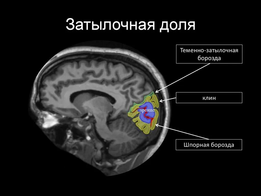 Доли мозга мрт. Анатомия затылочной доли головного мозга мрт. Анатомия височной доли мрт. Лобные извилины мрт анатомия. Доли головного мозга на кт анатомия.