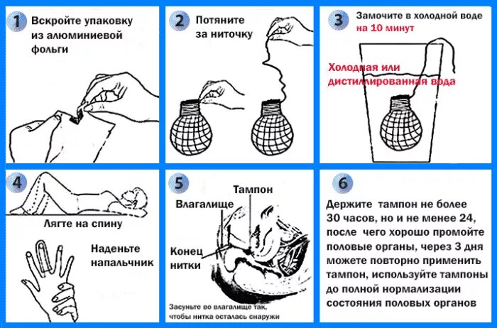 Спринцевания после акта. Тампоны с димексидом в гинекологии. Как вставить лечебный тампон. Тампоны для гинекологических процедур. Как вставить тампон с лекарством.