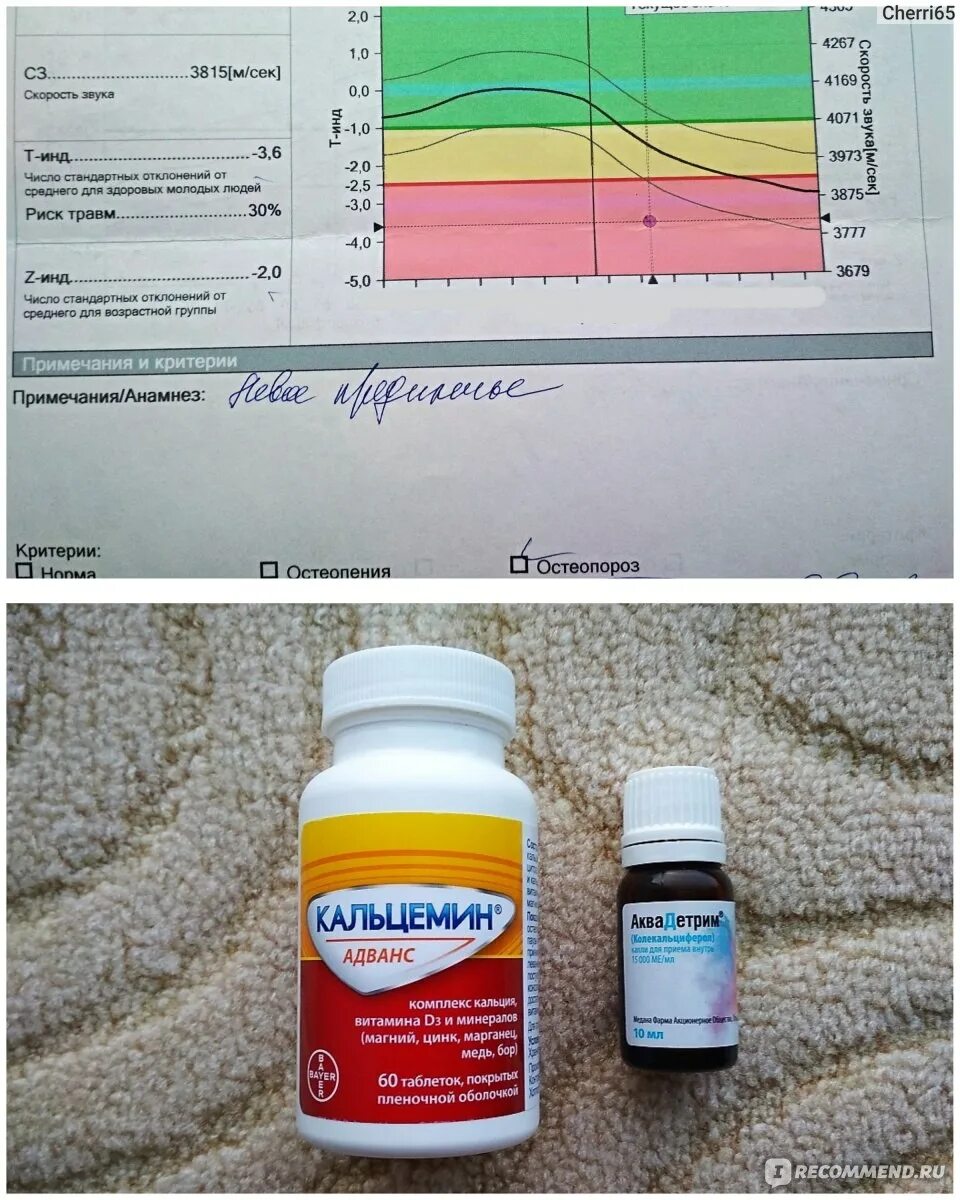 Аквадетрим кальций д3. Кальций д3 аквадетрим. Аквадетрим от остеопороза. Кальцемин адванс аквадетрим. D3 kaltsifit Akvadetrim.