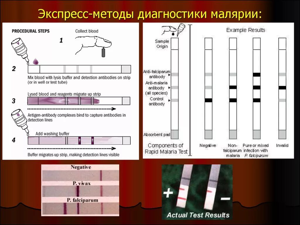 Методы экспресс диагностики микробиология. Методы лабораторной диагностики малярии. Метод лабораторной диагностики малярии. Экспресс методы диагностики малярии. Малярия ответы на тесты нмо эпидемиология