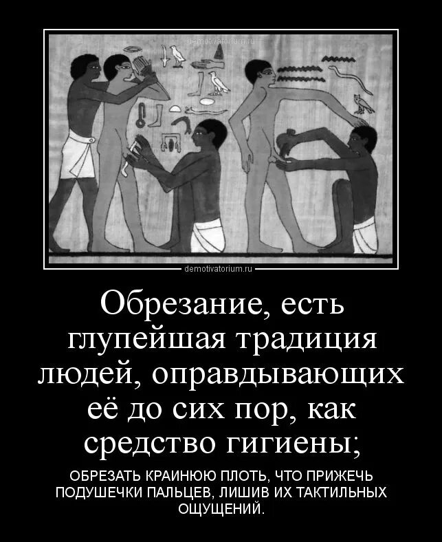 Частичное обрезание схема. Чем делают обрезание у евреев. Обрезание у мужчин схема. Плюсы и минусы обрезания крайней плоти