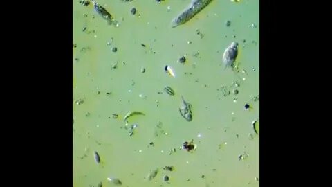 Морская вода под микроскопом