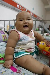 Baby fat
