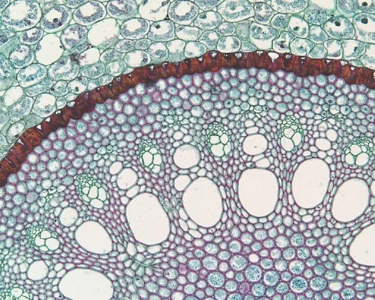 Woody Dicot Stem: Primary Phloem One Year Sambucus Flickr
