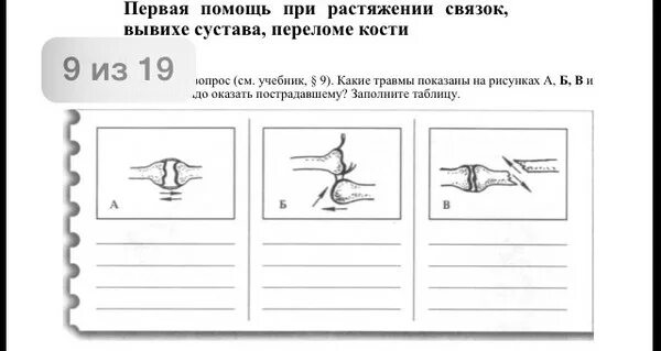 Какой вид травмы показан на рисунке. Какая травма показана на рисунке. Какая травма показана на рисунках а и б?. Какие травмы показаны на рисунках а б в и какую помощь. Какое раненре изображено на рисунке 2.