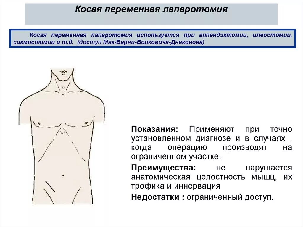 Лапаротомия что это такое простыми словами. Продольная лапаротомия. Верхнесрединная лапаротомия показания. Нижнесрединная лапаротомия разрез.