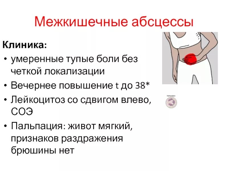 Больно при половом акте у женщин. Симптомы при раздражении брюшины. Симптомы раздражения брюшины. Симптомы раздражителя брюшины. Симптомы напряжения брюшины.