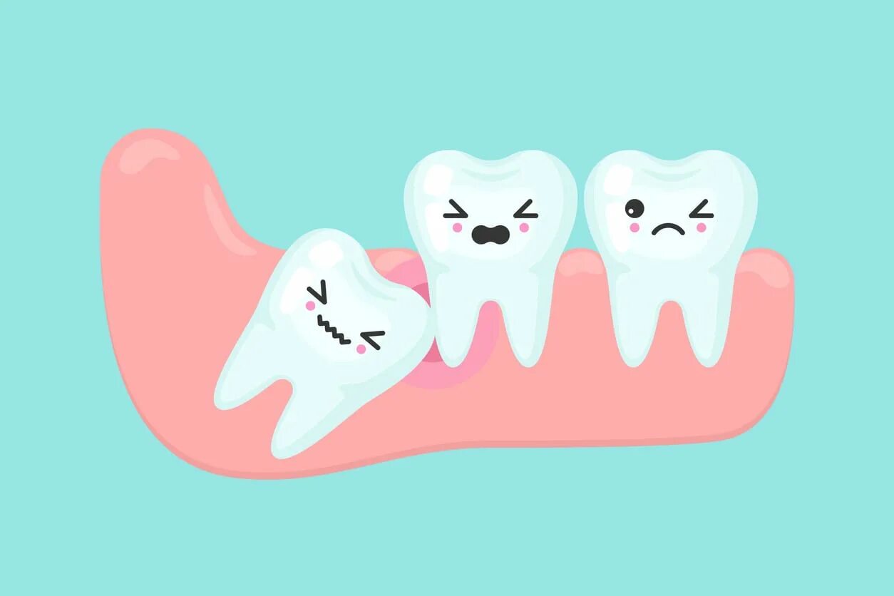 Tooth problems
