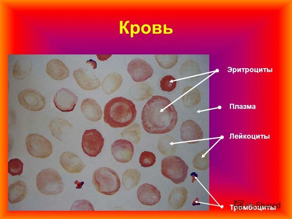 плазма лейкоциты. кровь состоит из плазмы и клеток крови. кровь плазма тромбоциты эритроциты. плазма лейкоциты. форменные элементы крови схема.