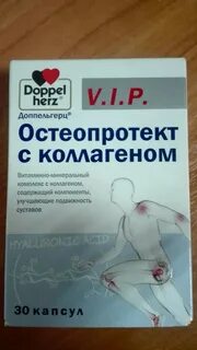 Доппельгерц артра