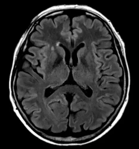 Снимки мрт головы здорового человека. Покажи нормальный снимок головного мозга на мрт. Фото мрт мозга в норме. Мрт головного мозга у детей с расстройством аутистического спектра. Кт головы москва