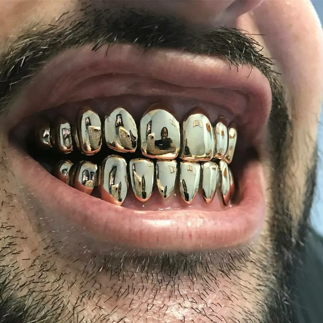 Сколько стоит металлические зубы. Золотые гриллзы.