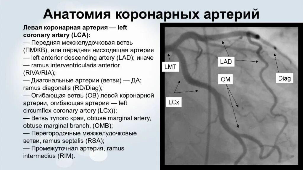 Коронарные артерии на коронарографии. Анатомия коронарных артерий. Анатомия сосудов сердца при коронарографии. Анатомия коронарных артерий коронарография.