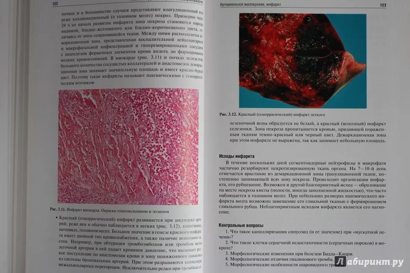 Основы патологической анатомии. Основы патологической анатомии