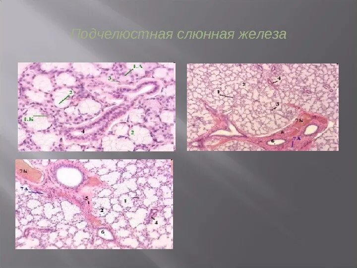 Околоушная слюнная железа гистология. Подчелюстная железа гистология препарат. Околоушная железа гистология препарат. Строение околоушной слюнной железы гистология. Околоушная железа препарат