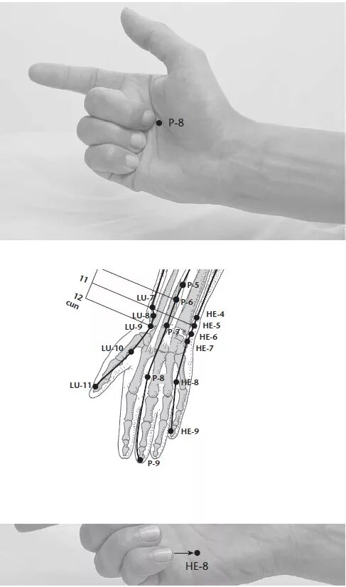 Точка мс 9. Точка Лао Гун акупунктура. Акупрессура Лао Гун. Акупунктурные точки Лао Гун. Шао фу точка акупунктуры.