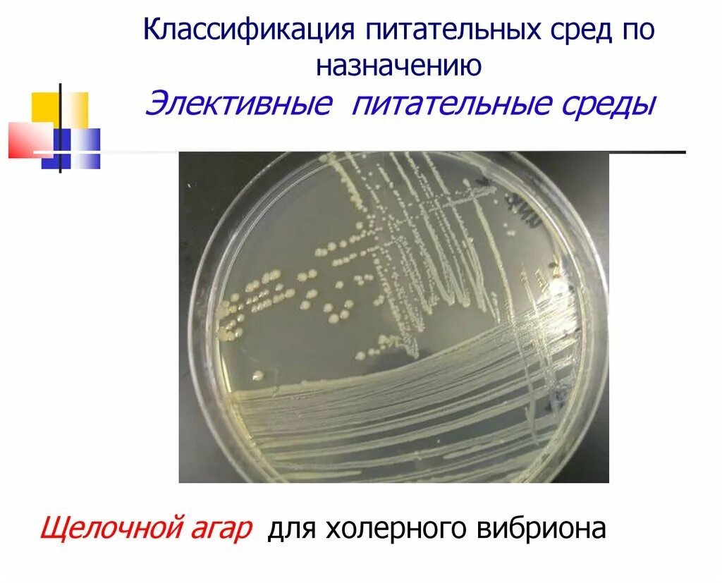 Холера питательные среды. Холерный вибрион на питательных средах. Рост холерного вибриона на щелочном агаре. Питательные среды для культивирования холерного вибриона. Питательная среда для культивирования Vibrio cholerae.