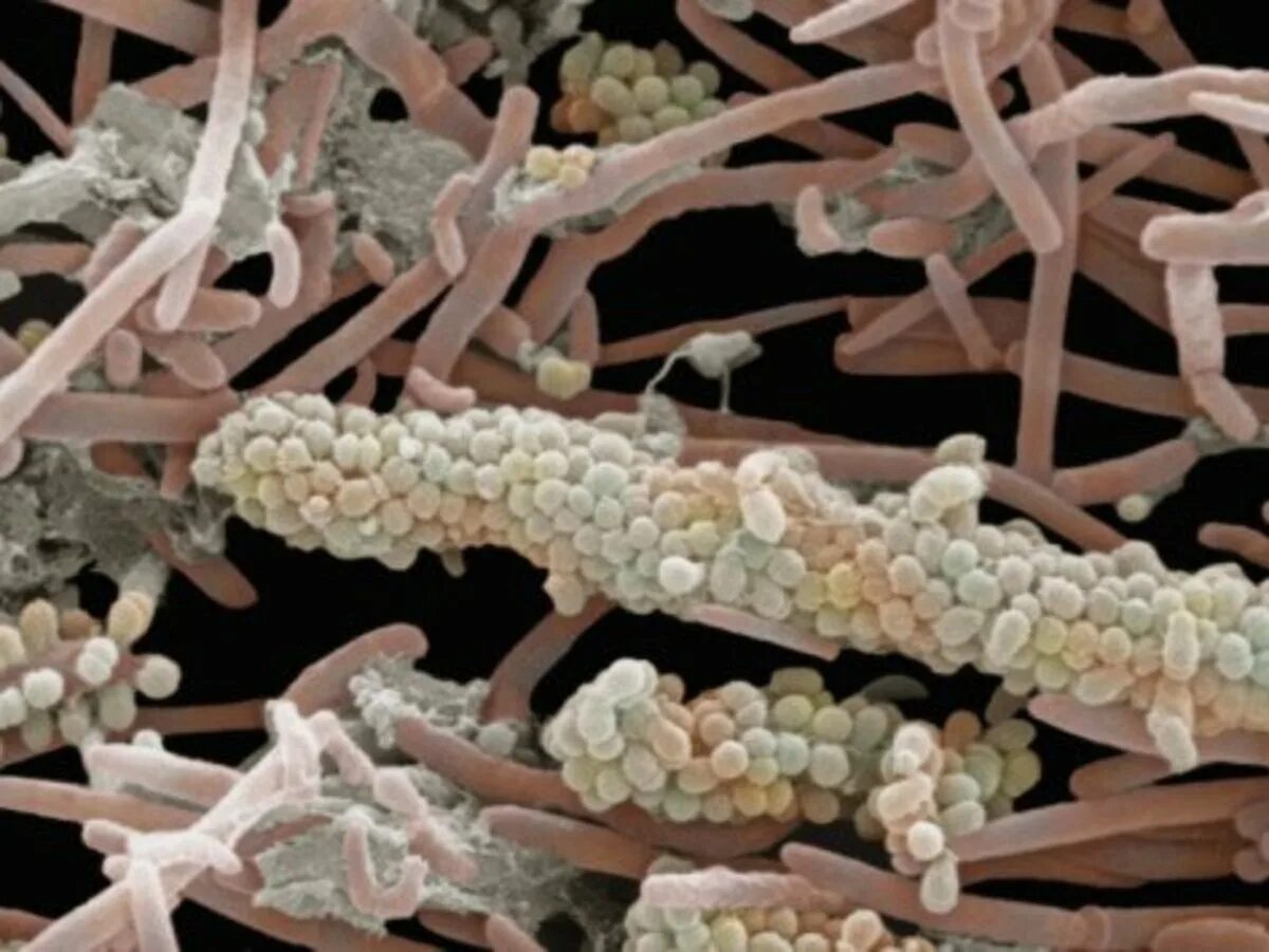 Бактерии в слюне. Бактерии на зубах под микроскопом. Микроорганизмы под микроскопом. Микробы на зубах под микроскопом. Микробы во рту под микроскопом.