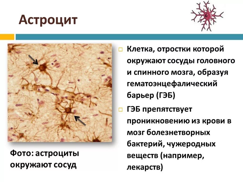 Астроциты спинного мозга. Астроциты головного мозга. Нейроглия в спинном мозге. Клетки головного мозга астроциты. Астроцит клиника