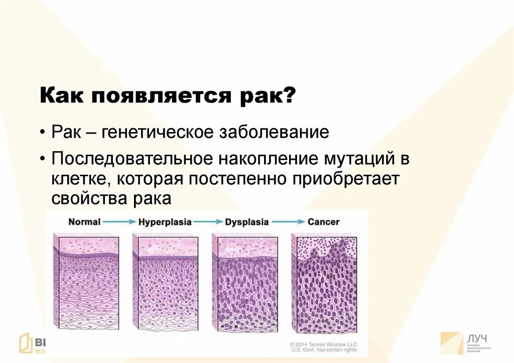 Почему бывает рак. Как появляется онкология. Как возникает онкология. Как образуется онкология. Онкология из за чего возникает.