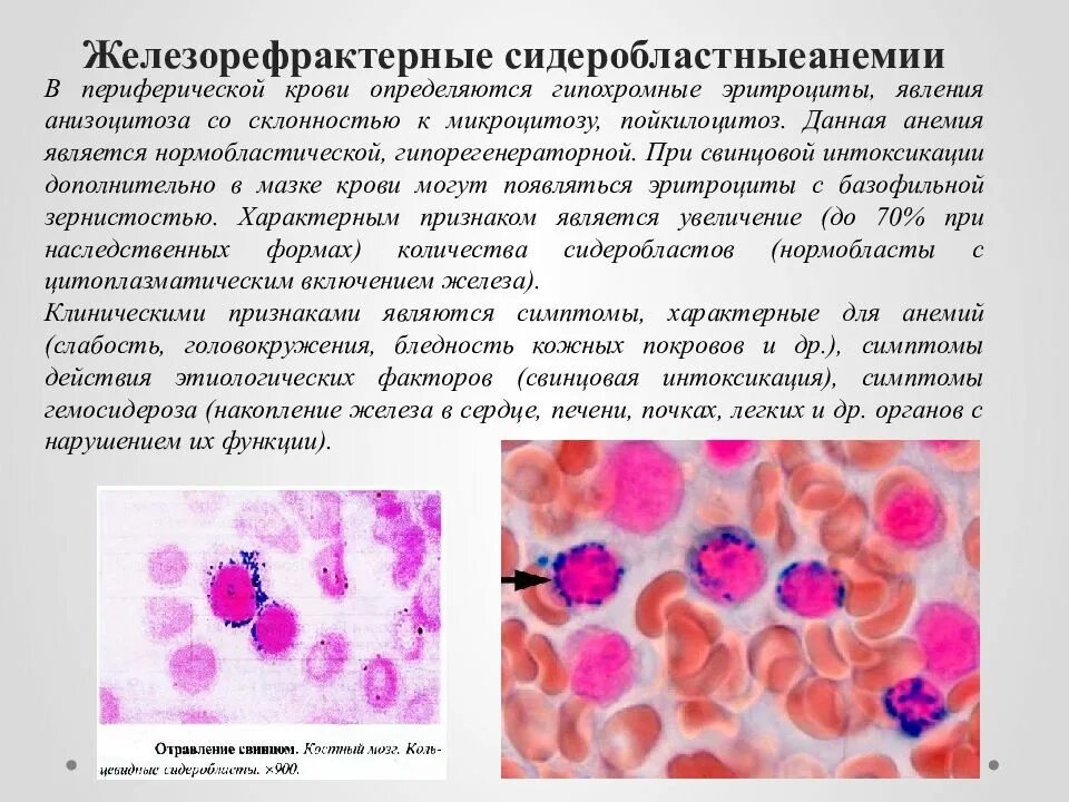 Печень образование эритроцитов. Функции периферической крови. Гипохромные микроцитарные анемии. Эритроциты в периферической крови. Нарушение системы эритроцитов..