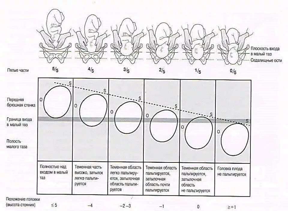 Как определить в каком положении находится. Оценка динамики опускания головки плода. Положение головки в плоскостях малого таза. Определение положения головки плода во время родов. Сегменты головки плода.