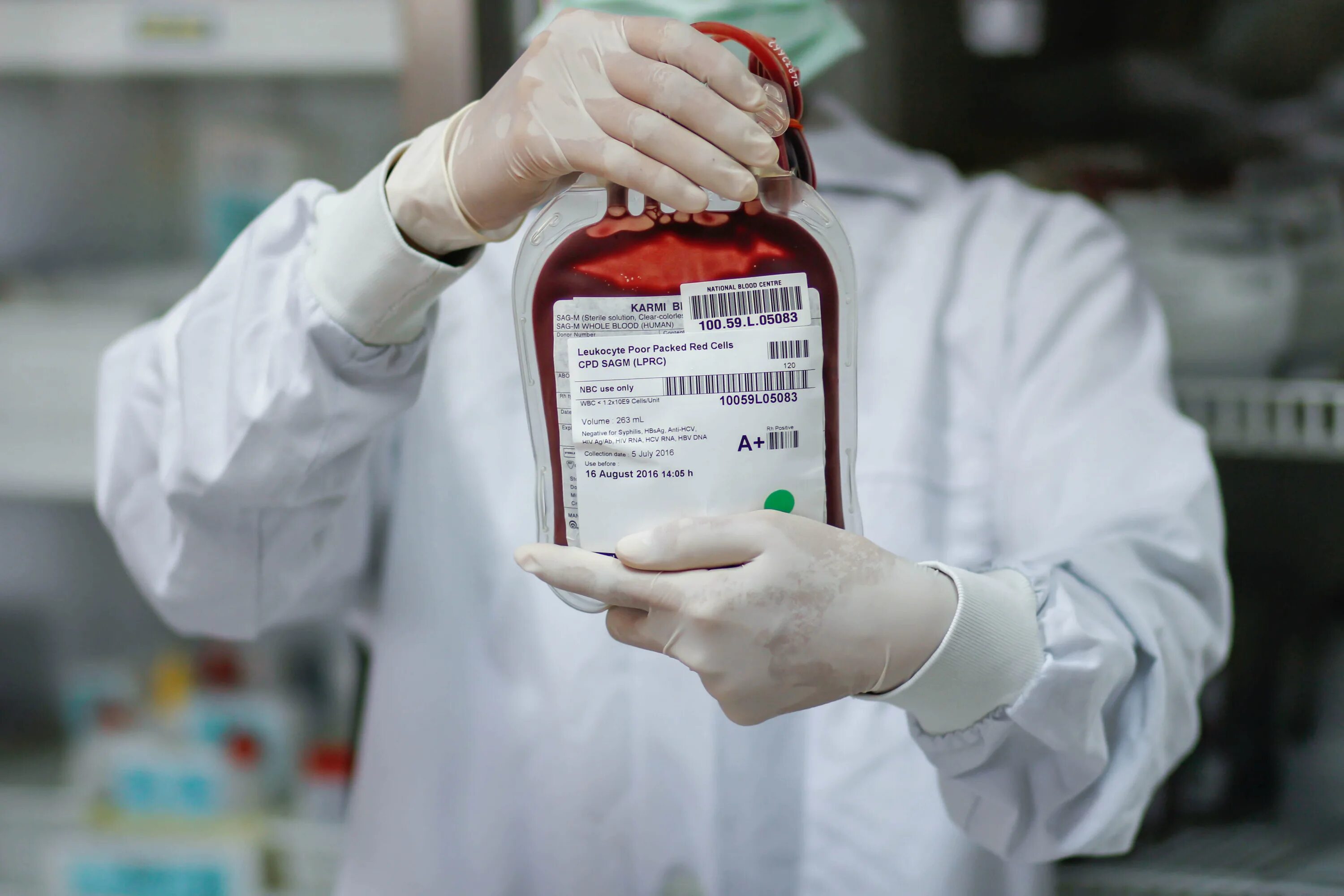 Переливание донорской крови. Трансфузиология крови. Переливание консервированной крови. 3 препараты крови
