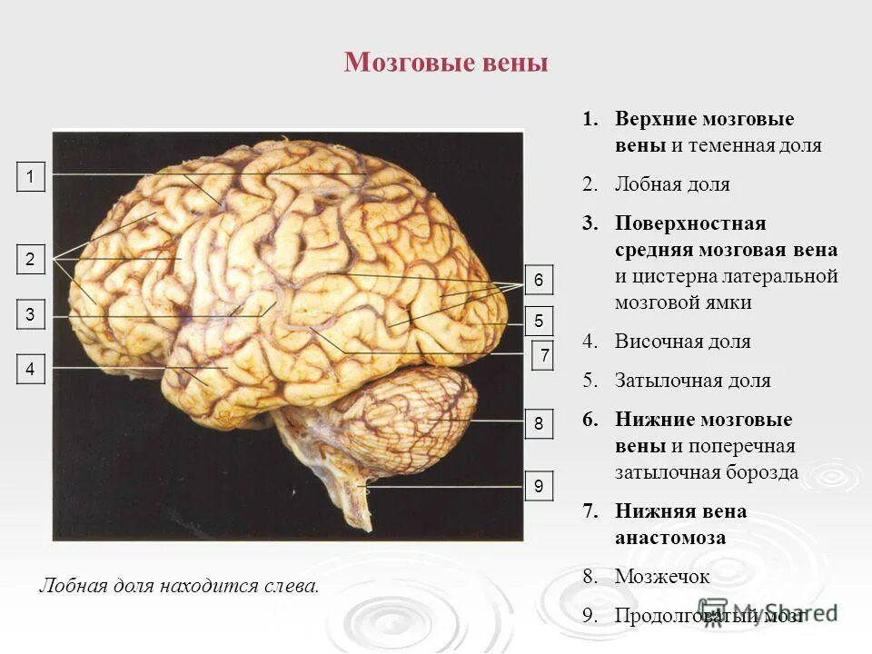 Борозды височной доли. Извилины височной доли головного мозга. Борозды лобной доли мозга. Борозды и извилины лобной доли.