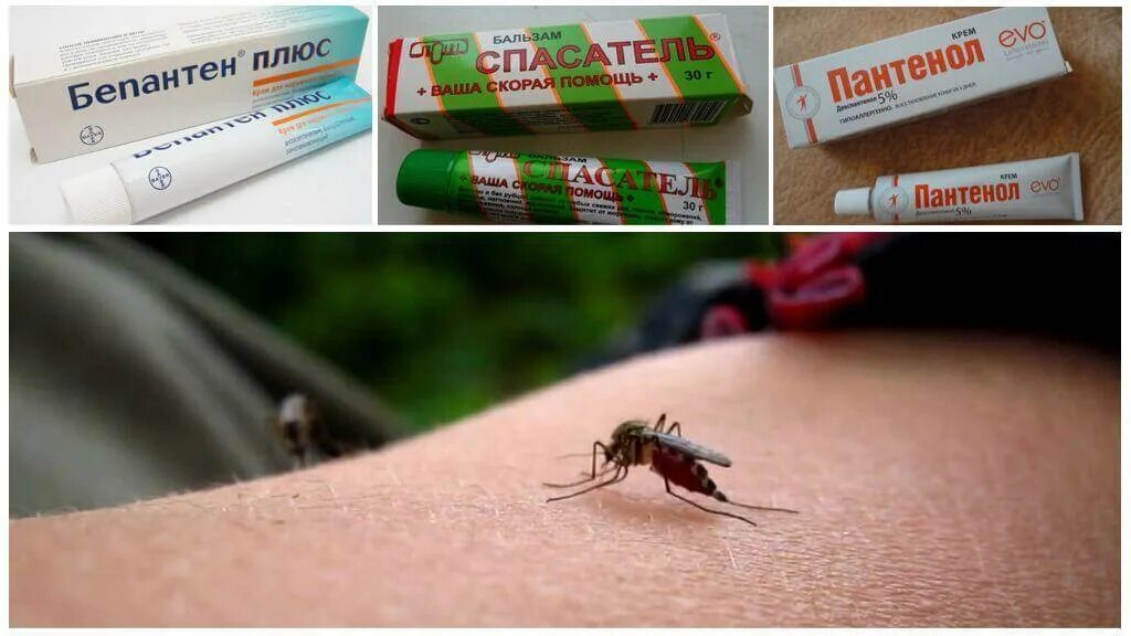 Мазь от укусов комаров. Средство от укуса комара. Чем обработать укусы в домашних условиях