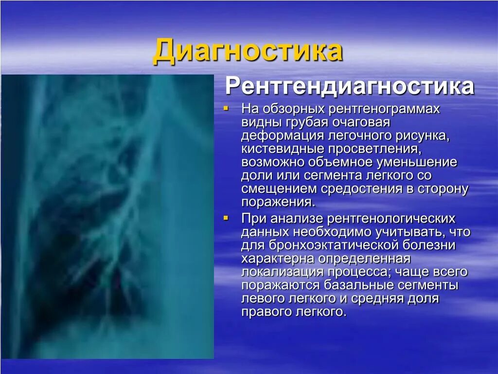 Бронхоэктатическая болезнь диагноз. Бронхоэктатическая болезнь бронхография. Бронхоэктазы на рентгенограмме. Бронхоэктазы рентген. Бронхоэктатическая болезнь рентген.