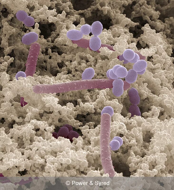 Термофильные молочнокислые стрептококки. Болгарская палочка (Lactobacterium bulgaricum). Болгарская палочка и термофильный стрептококк. Ацидофильные лактобактерии (Lactobacillus Acidophilus).