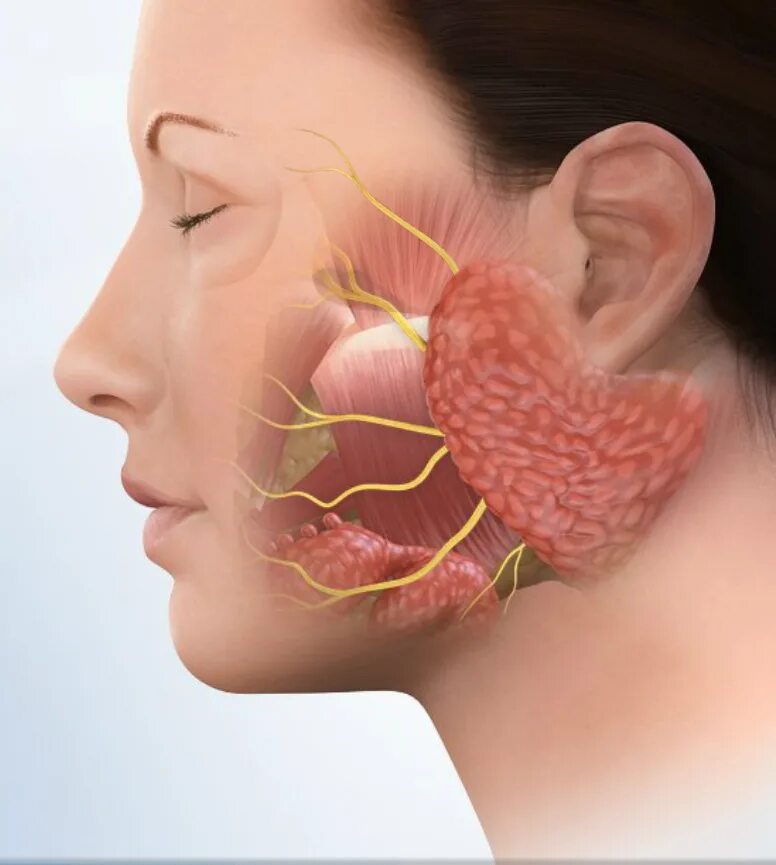 Воспаление околоушной слюнной железы. Паротит (воспаление околоушных желез). Околоушная железа серозная. Околоушная слюнная железа нерв. Нервы околоушной железы