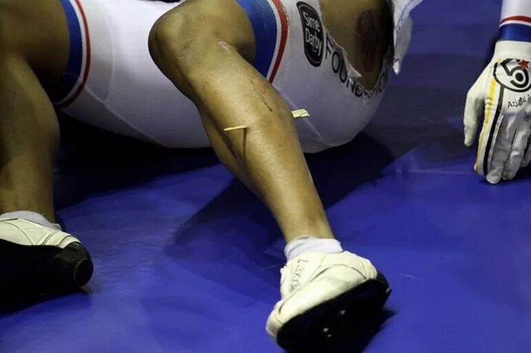 Травмы спортсменов. Ноги спортсменов на треках.