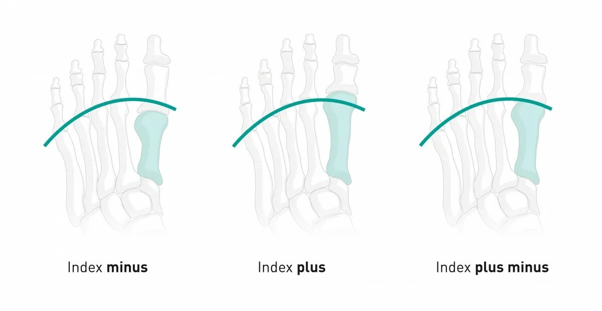 Is more plus than minus. Индекс минус стопы. index plus.