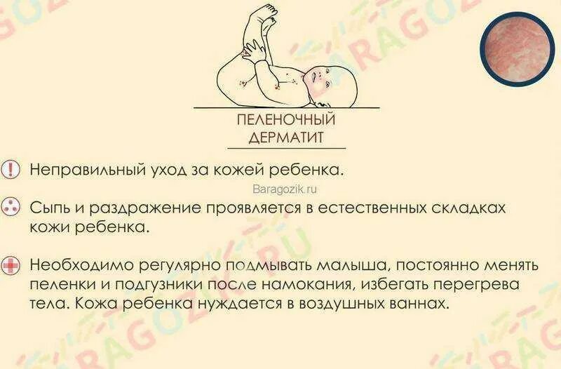Pin by Mary Ross on The Best Diaper Rash Cream (So, What’s Safe For My Baby?) Be
