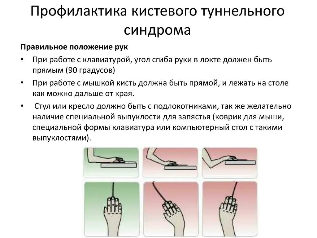 Кистевой туннельный синдром. Гимнастика для кистей рук туннельный синдром. Профилактика туннельного синдрома. Туннельный синдром синдром. Туннельный синдром после операции