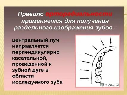 Зубы под углом