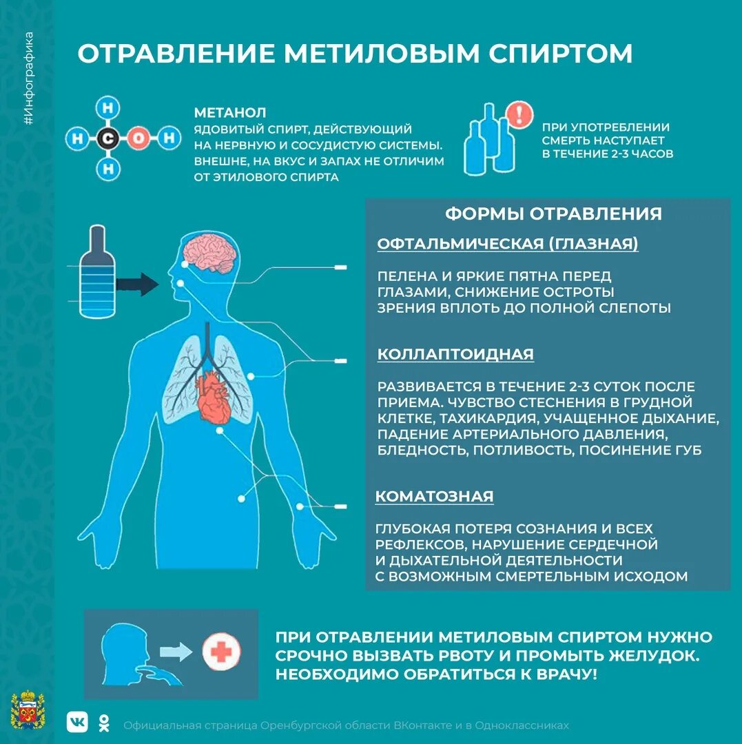 Отравление метанолом. Массовое отравление метанолом. Отравление метанолом симптомы.