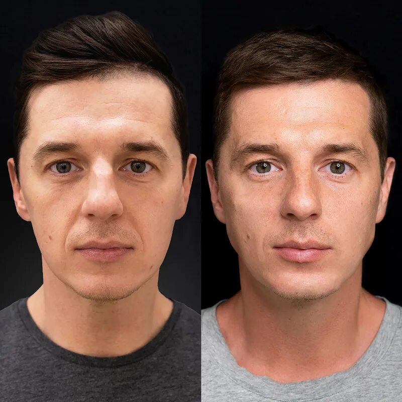 скулы у парней. красивые парни со скулами. как сделать скулы парню. как сделать скулы парню. скулы мужские.