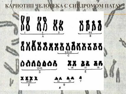 Число аутосом в яйцеклетке