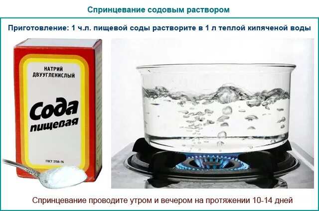 Какой спринцевание. Спринцевание раствором соды. Спринцевание содой при молочнице. Спринцеваться содой при молочнице. Содовый раствор для промывания влагалища.