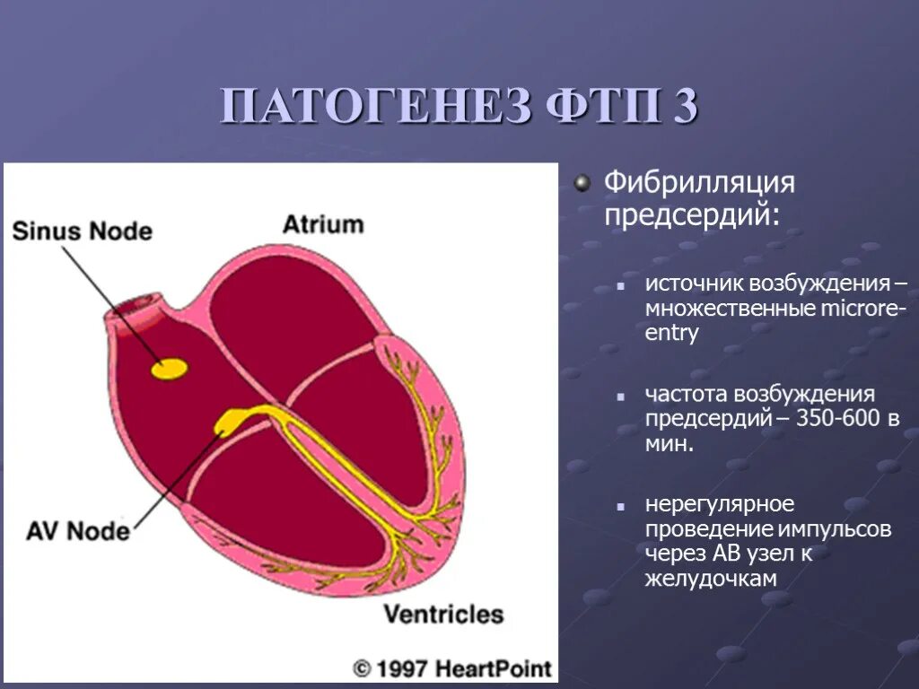 Патогенез фибрилляции предсердий. Фибрилляция предсердий этиология. Фибрилляция предсердий патогенез рисунок. Предсердие болезни