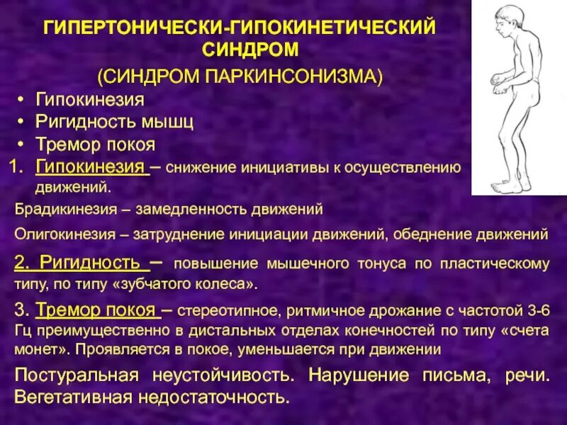 Ригидность тремор. Поза просителя при болезни бехтерева. Клинические проявления болезни паркинсона. Семиотика картинки. Походка при паркинсонизме.