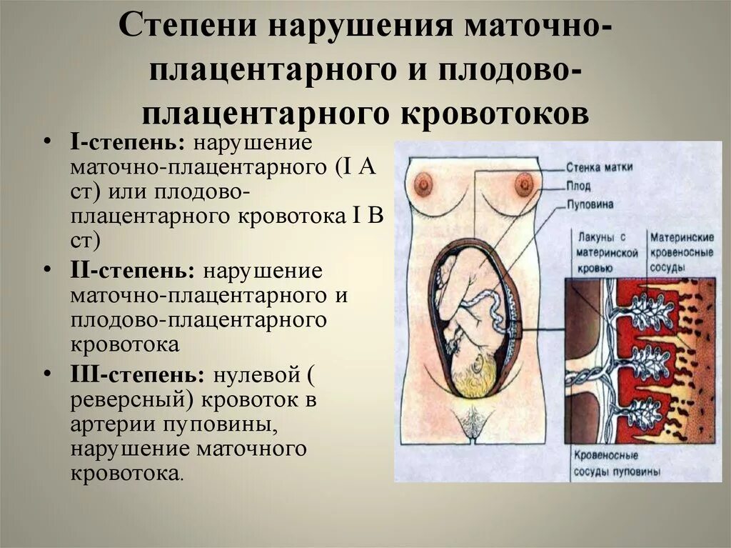 Степени нарушения кровотока при беременности. Маточно-плацентарный кровоток 1а. Маточно-плацентарный кровоток 1а степени. Нарушение маточного кровотока 1 ст при беременности. Нарушения кровотока при беременности 1 а степени при беременности.