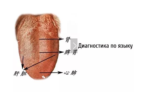 Как определить больной орган. Заболевания по цвету языка. Болезни по языку определить. Выявление болезни по языку.