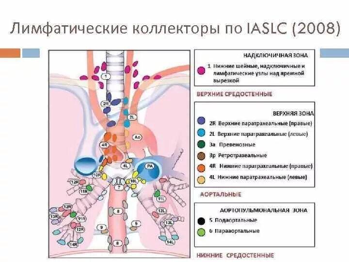 Внутригрудные лимфатические узлы схема. Лимфоузлы средостения схема. Регионарные лимфоузлы легких. Классификация лимфоузлов средостения. Увеличение лимфоузлов в легких причины