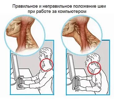Боль в шее слева
