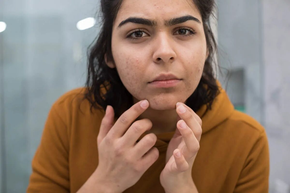 Hairy face. Гирсутизм наблюдается при. Female facial hair.